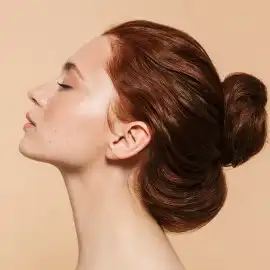 Cabello graso